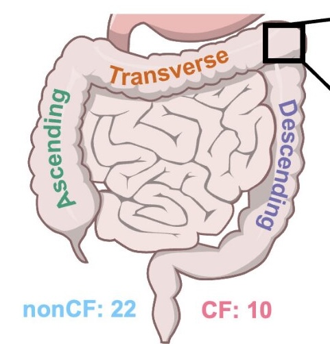 CF Gut Microbiome